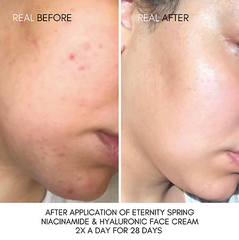 NUT Niacinamide Hyaluronic Acid Face Cream (Eternity Spring)