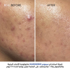 MarineBio 5% Niacinamide Face Serum