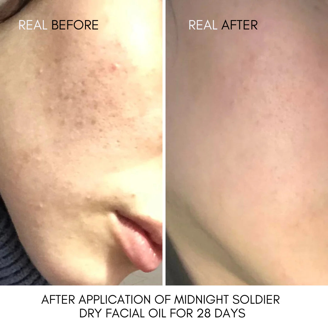 Nut's Bright Complexion Night Skincare Kit (Face Cream + Night Oil)