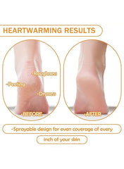 مقشر القدم الكوري - FOOT PEELING SPRAY
